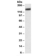 Anti-PMCA1