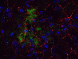 Anti-Beta Amyloid