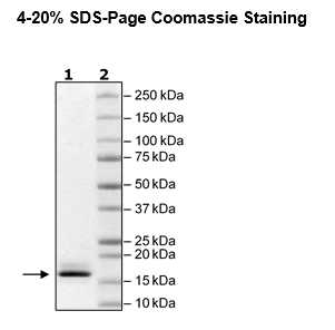 DPY30, human recombinant protein, N-terminal His tag