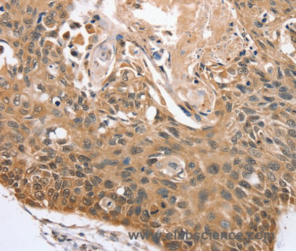 Anti-RBM38