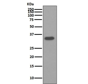 Anti-Osteopontin / OPN / SPP1, clone CEO-19