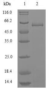 Nucleoprotein (NP), Influenza B virus, recombinant