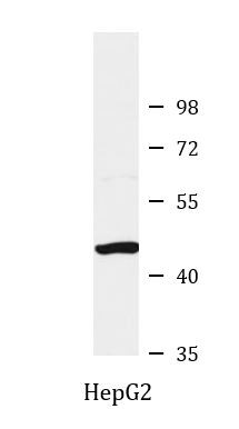 Anti-SLC16A7 / MCT2