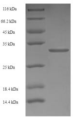 Retinoic acid receptor responder protein 2 (RARRES2), human, recombinant
