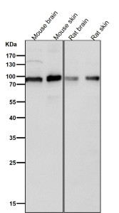 Anti-phospho-UBF1 (Ser484) / Upstream-binding factor 1, clone 32U21