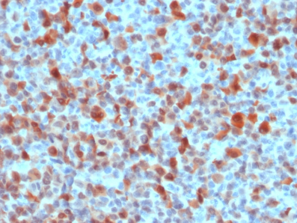 Anti-S100B (Astrocyte and Melanoma Marker)(), CF568 conjugate, 0.1mg/mL