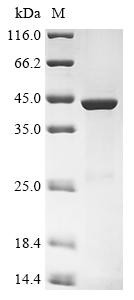 Ceroid-lipofuscinosis neuronal protein 5 (CLN5), human, recombinant