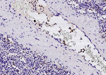 Anti-ficolin 1/FCN1/FCNA Monoclonal Antibody