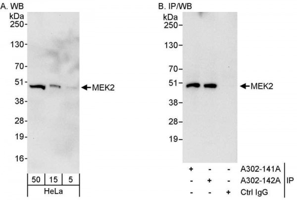 Anti-MEK2