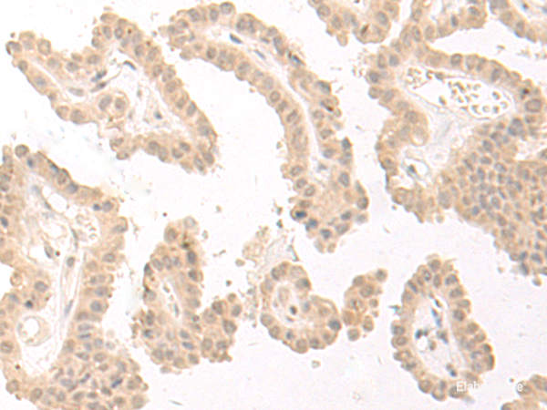 Anti-PBXIP1