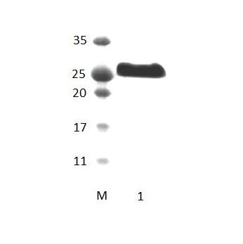 GORASP2 PDZ Domain
