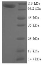 Myotubularin-related protein 7 (MTMR7), human, recombinant