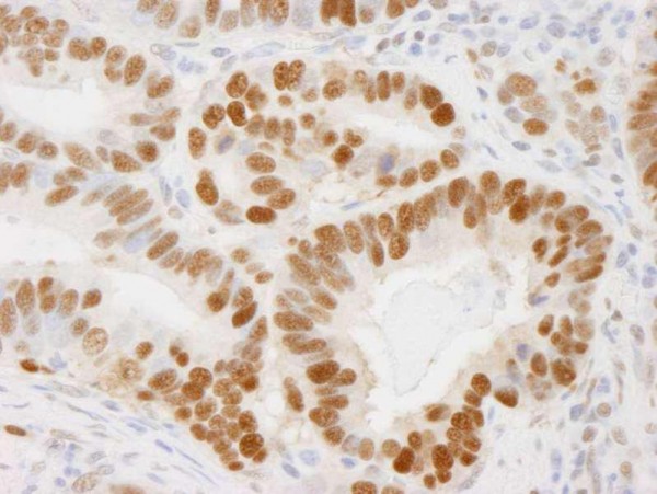 Anti-PCNA (IHC)