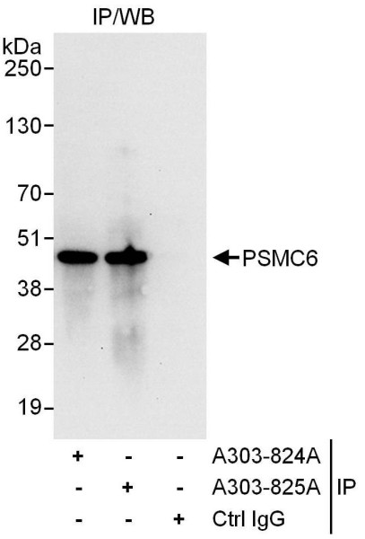 Anti-PSMC6