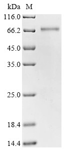 Sphingomyelin phosphodiesterase 3 (SMPD3), partial, human, recombinant