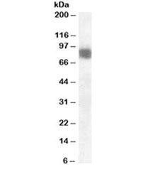 Anti-Cortactin