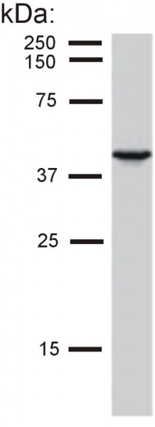 Anti-Cytokeratin 19, clone BA-17