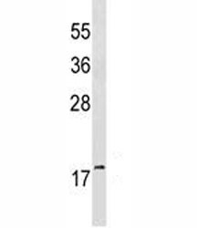 Anti-GABARAP, clone 424CT5.1.6