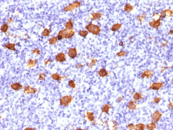 Anti-CD30 / TNFRSF8 (Hodgkin &amp; Reed-Sternberg Cell Marker)