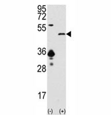 Anti-SIRT7