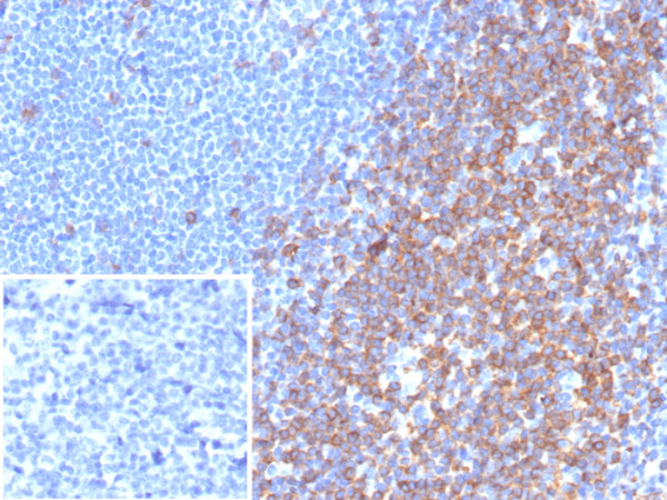 Anti-CD7 (T-Cell Leukemia Marker), recombinant antibody, clone rCD7/6972