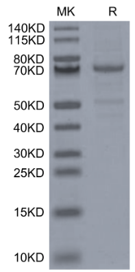 CDH3/Cadherin 3, His, Mouse