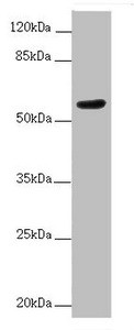 Anti-ACVRL1