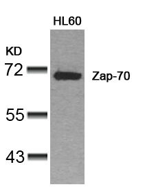 Anti-ZAP70 (Ab-319)