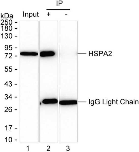 Anti-HSPA2