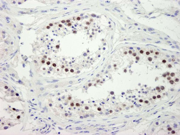 Anti-ZWINT-1 (IHC)