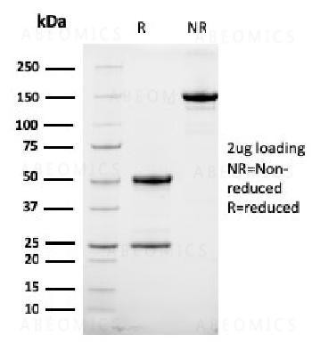 Anti-HER-2 / c-erbB-2 / neu / CD340 Monoclonal Antibody (Clone: HRB2/258)