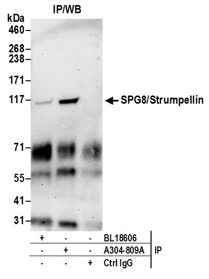 Anti-SPG8/Strumpellin