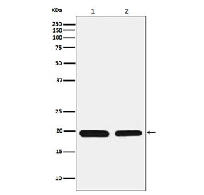 Anti-FTL / Ferritin light chain, clone ACBG-6