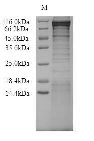 Nucleolar transcription factor 1 (UBTF), human, recombinant