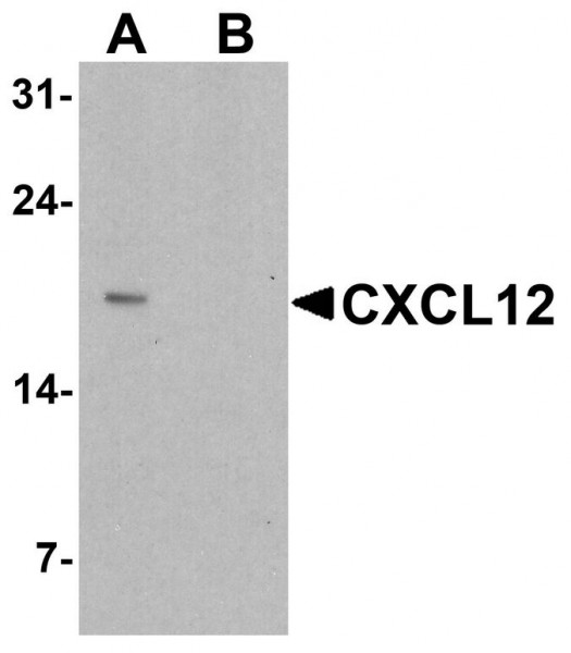 Anti-CXCL12 / SDF-1