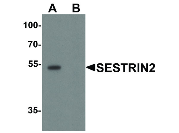 Anti-SESTRIN2