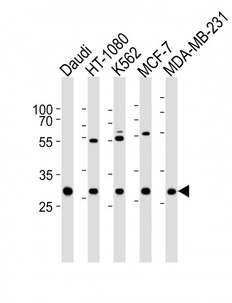 Anti-PNP / Purine nucleoside phosphorylase