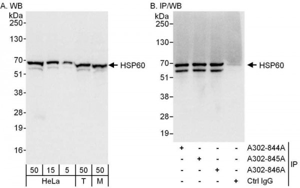 Anti-HSP60