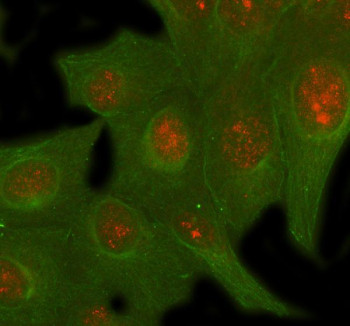 Anti-SIRT6 / Sirtuin 6