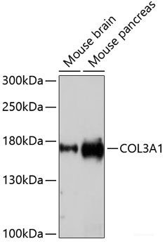 Anti-COL3A1