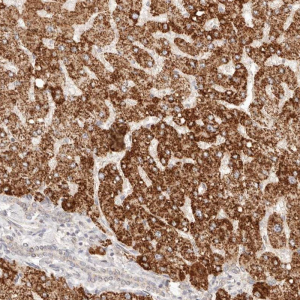 Anti-IL1R2