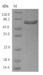 O6:H1 Exopolyphosphatase (ppx), Escherichia coli, recombinant