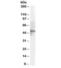 Anti-HTR1B