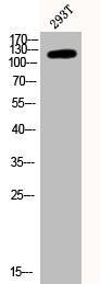 Anti-Phospho-PTK2 (Y397)