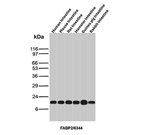 Anti-FABP2 / Fatty acid binding protein 2, clone FABP2/6344