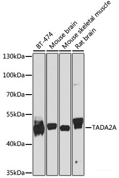 Anti-TADA2A