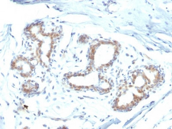 Anti-BAP1 / BRCA1-Associated Protein 1, clone BAP1/2432