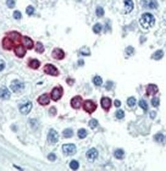 Anti-Cyclin D1 / CCND1