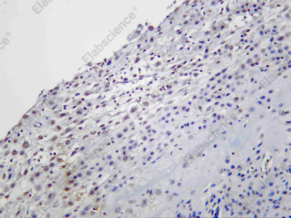 Anti-Recombinant Daxx, clone C111963