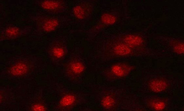 Anti-PRPF39